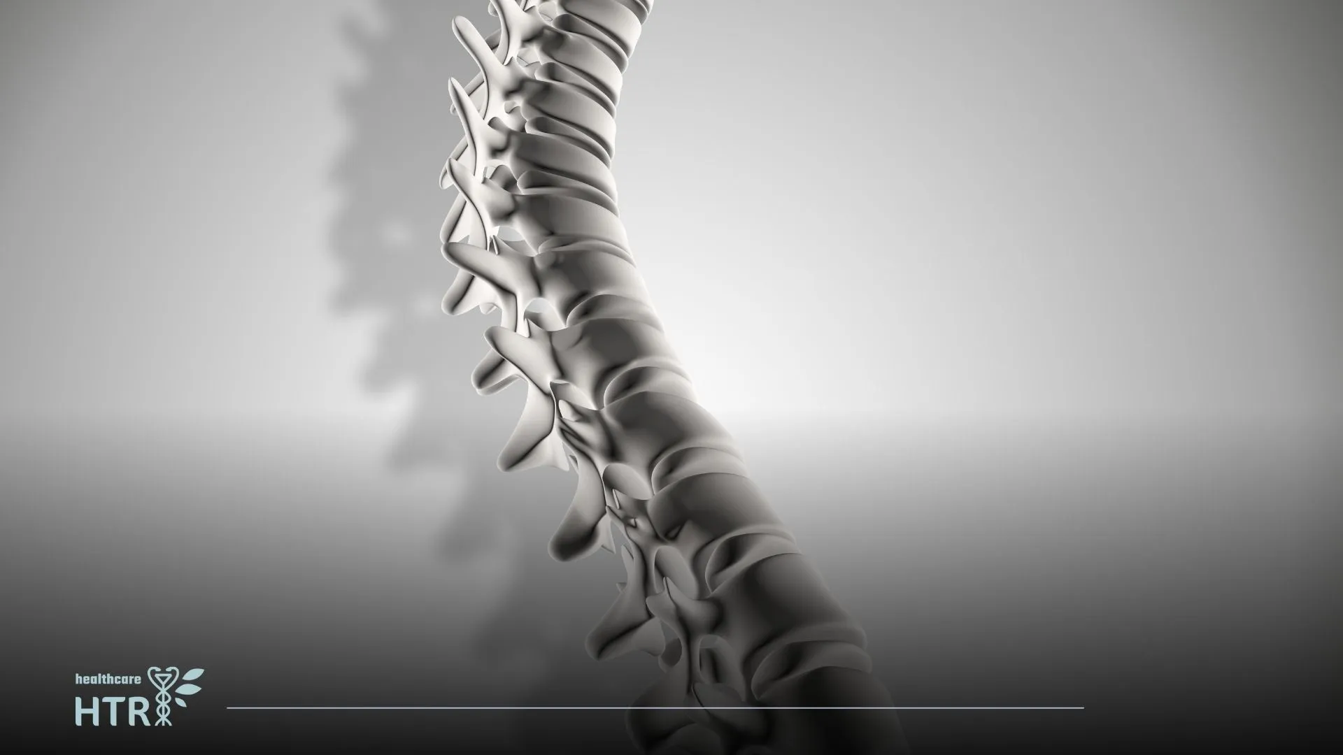 Regain Your Mobility and Freedom: Discectomy Surgery for Spinal Relief