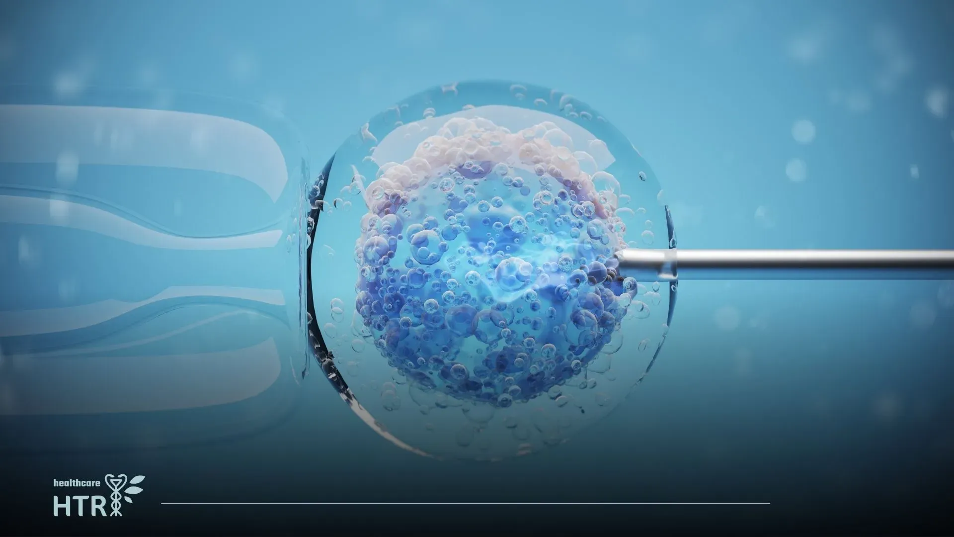 IVF