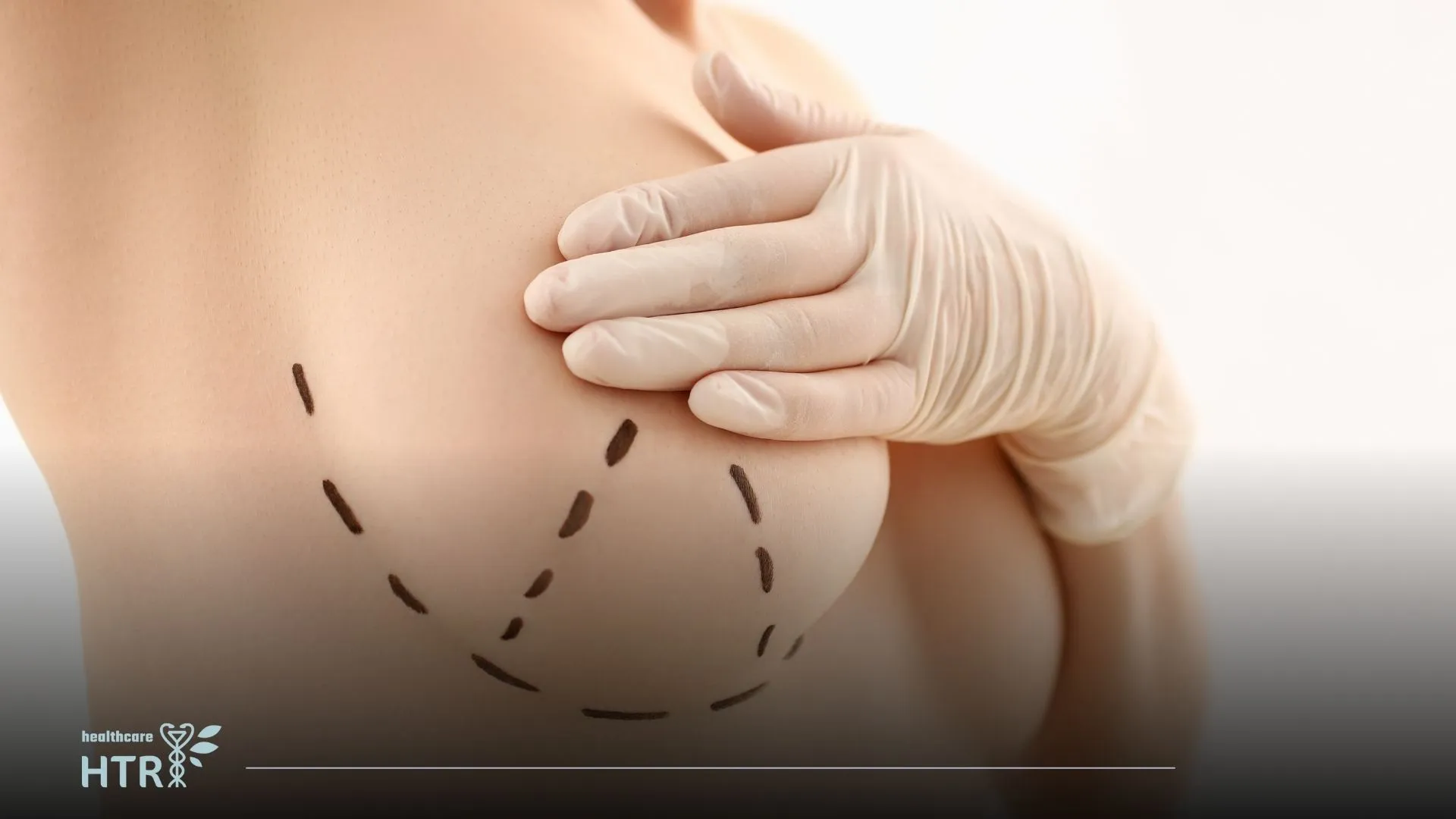 Breast Enlargement: Achieve Your Desired Shape with Confidence