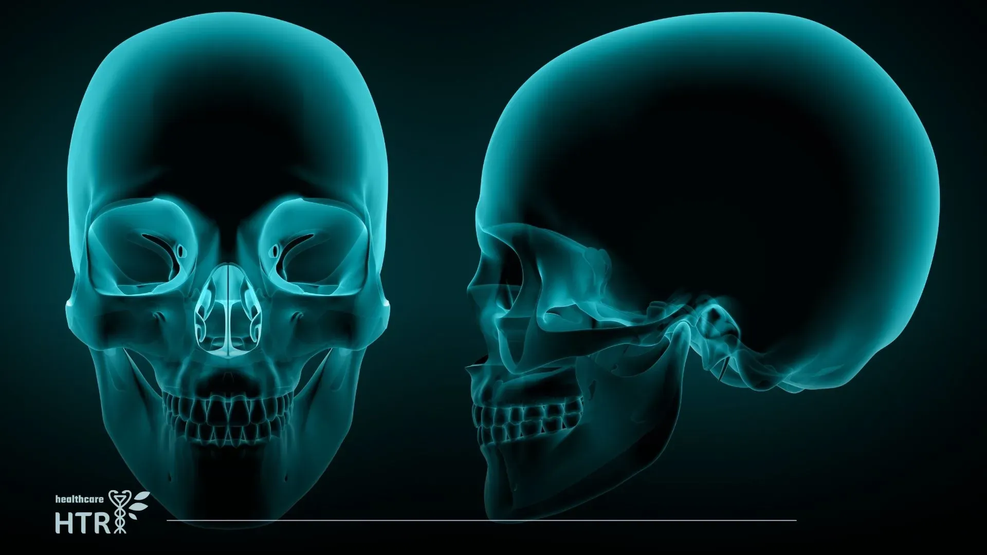 Neurosurgery