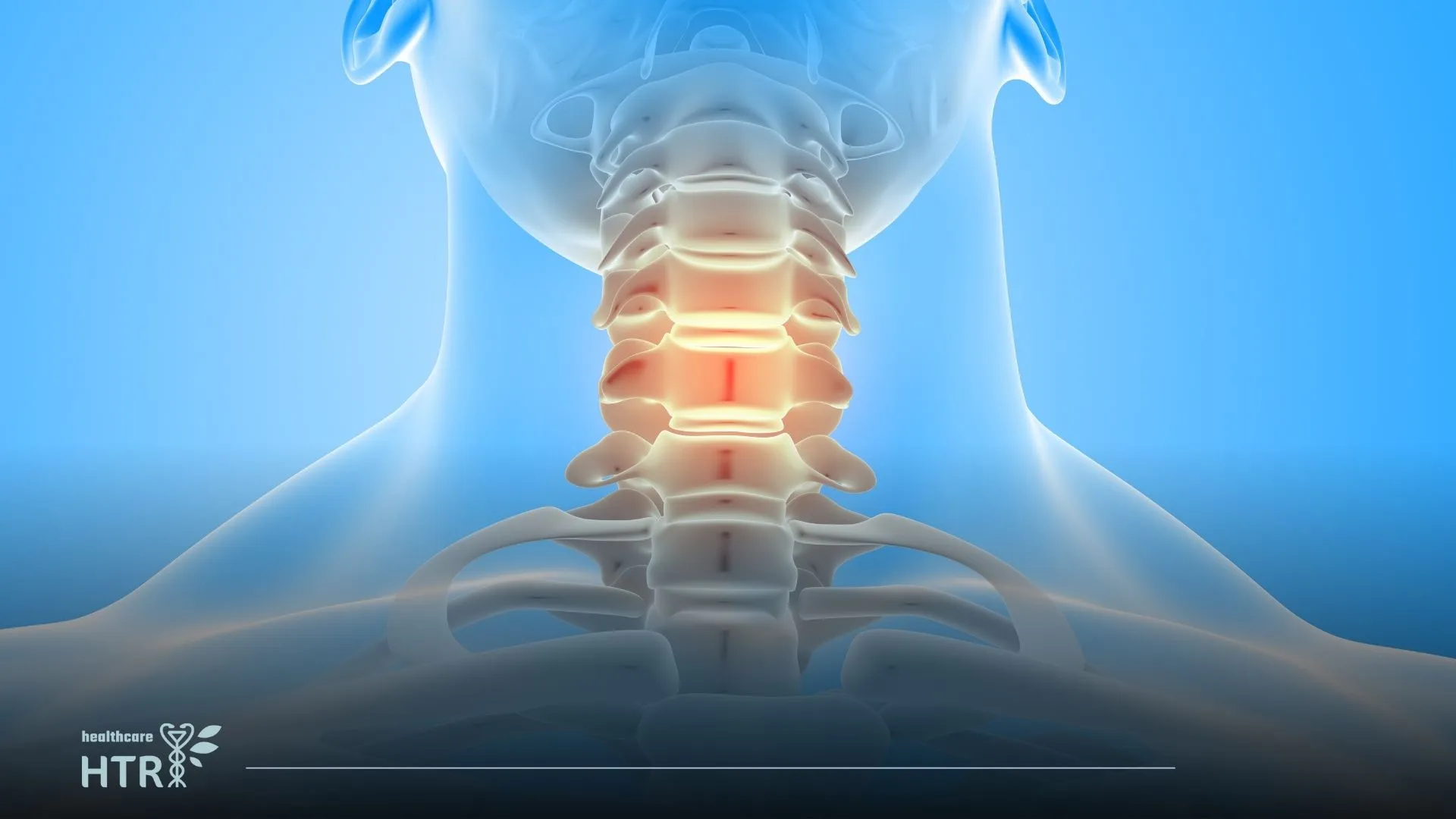 Say Goodbye to Chronic Pain with Spinal Cord Stimulation Surgery