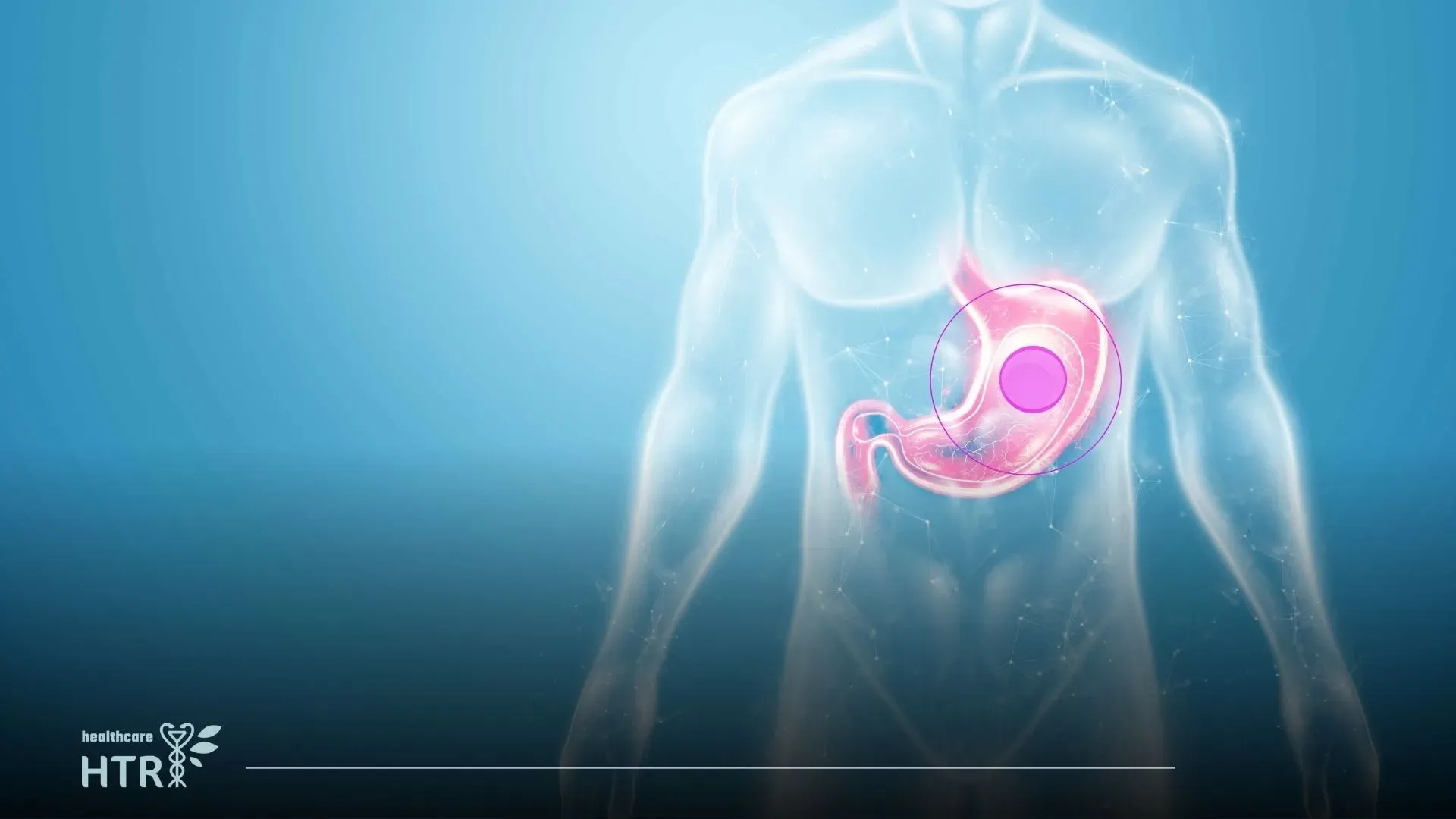 Bariatric Surgery