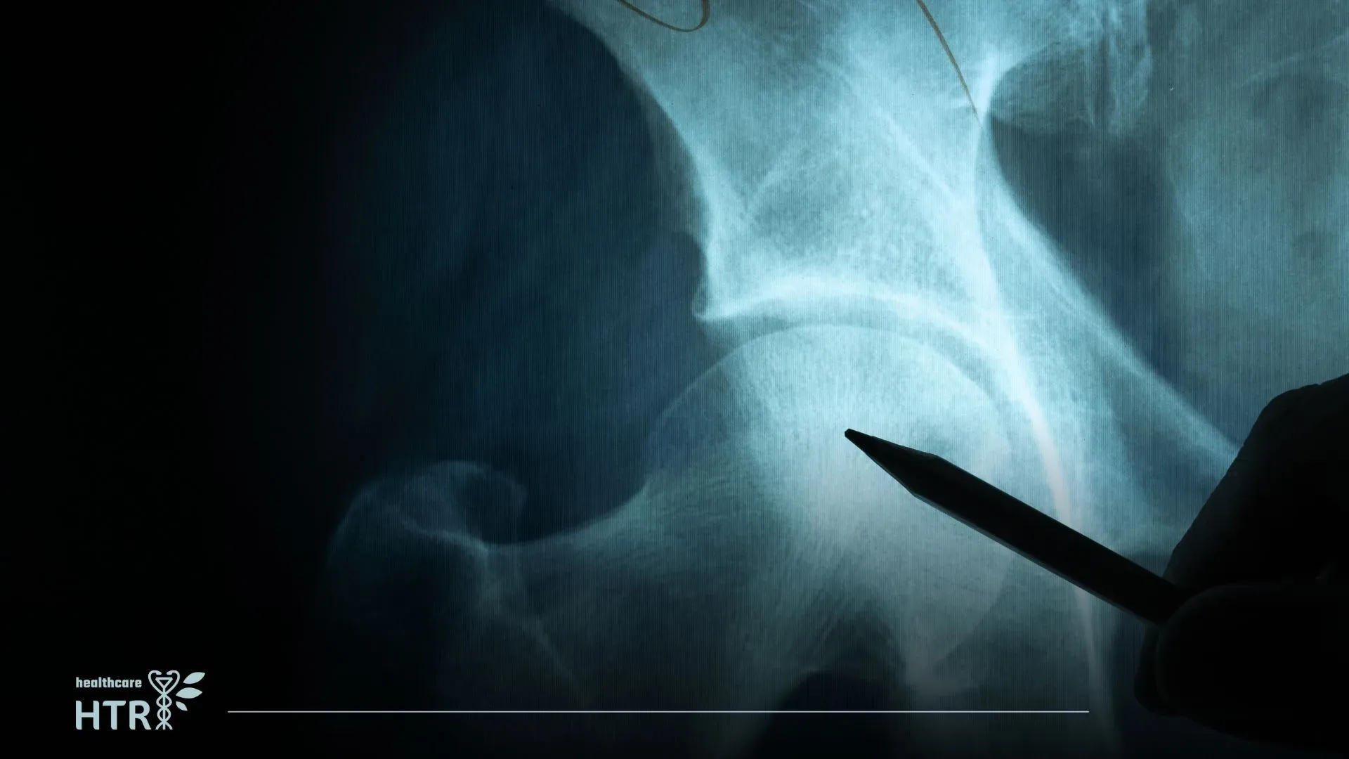 Neurosurgery